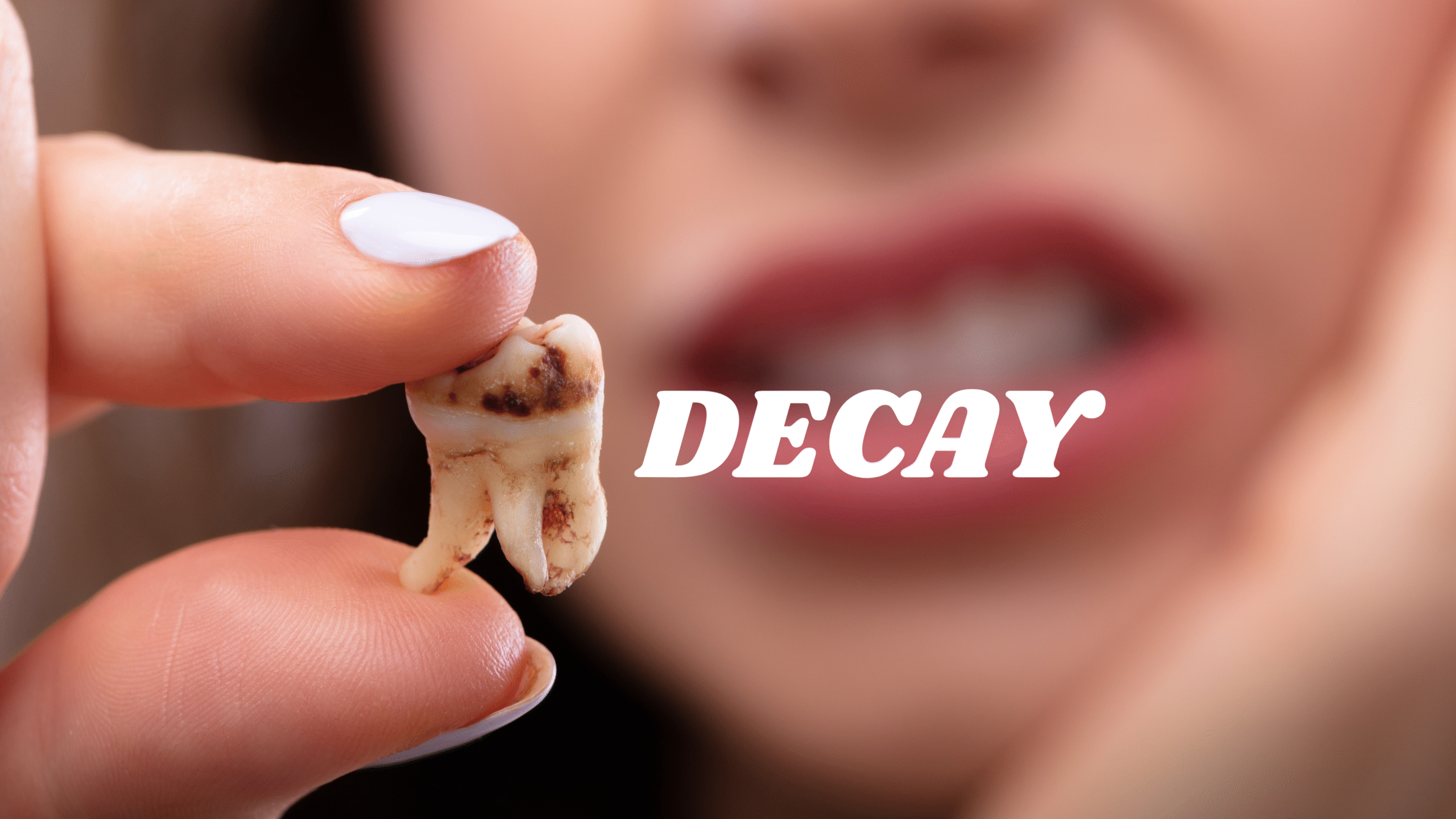 Tooth Decay Trouble? Here’s What You Need to Know About Dental Caries