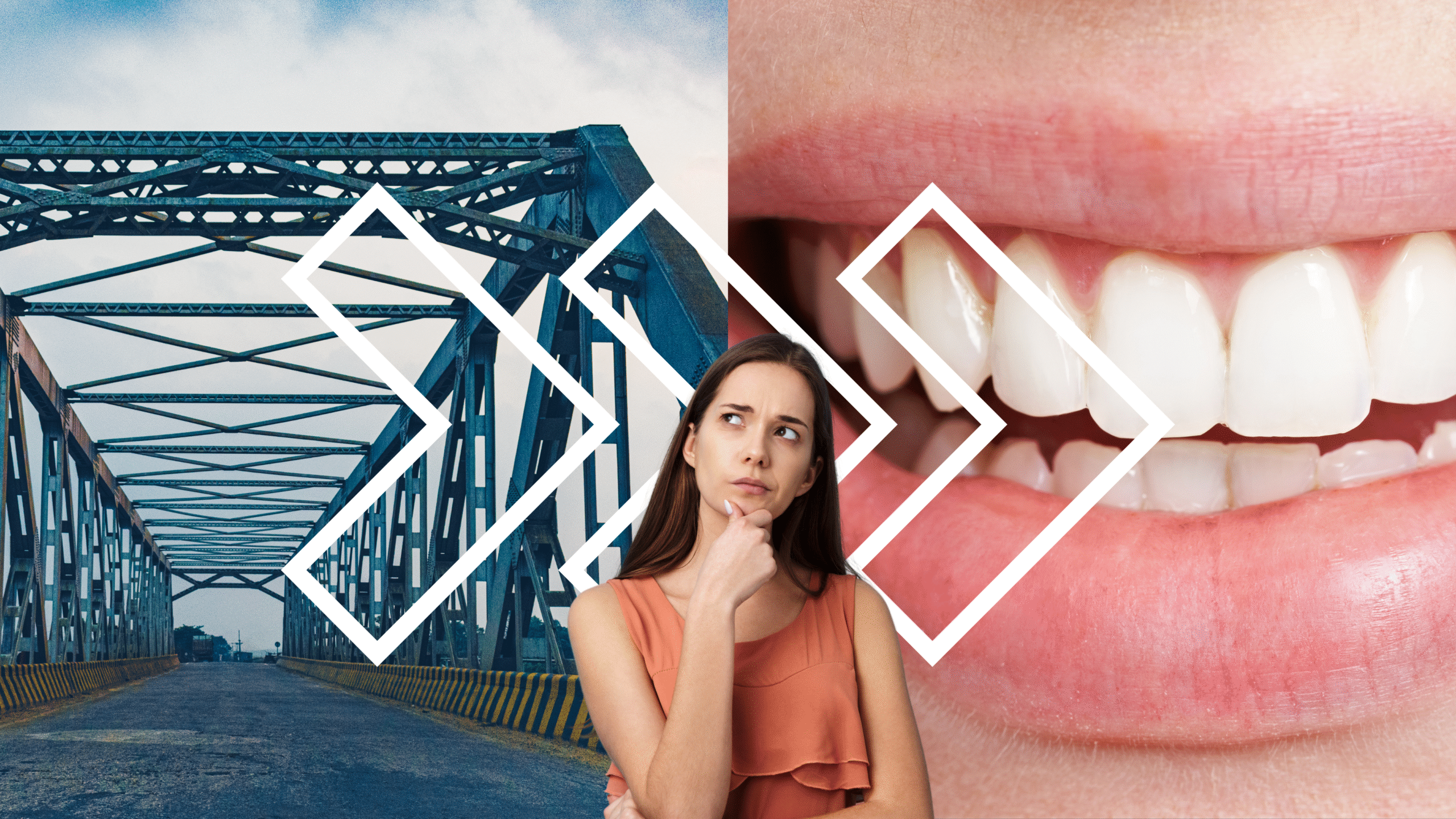 A Revolutionary Dental Breakthrough: From Steel Bridges to Stronger Smiles