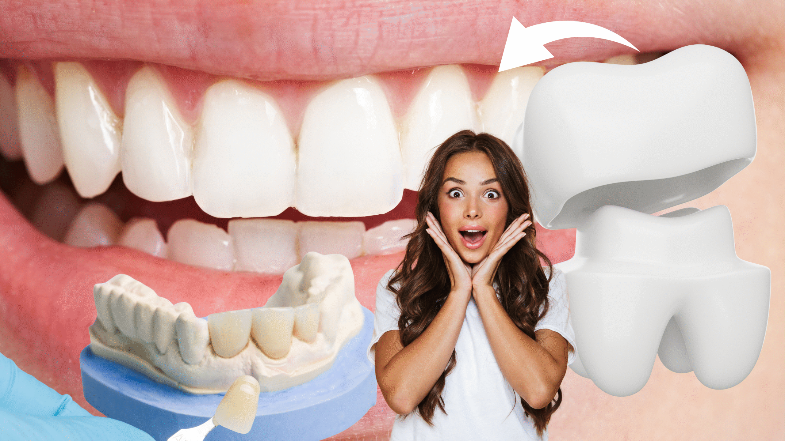Smile Makeover with Dental Veneers: Everything You Need to Know from the Best Dentist in Ghaziabad