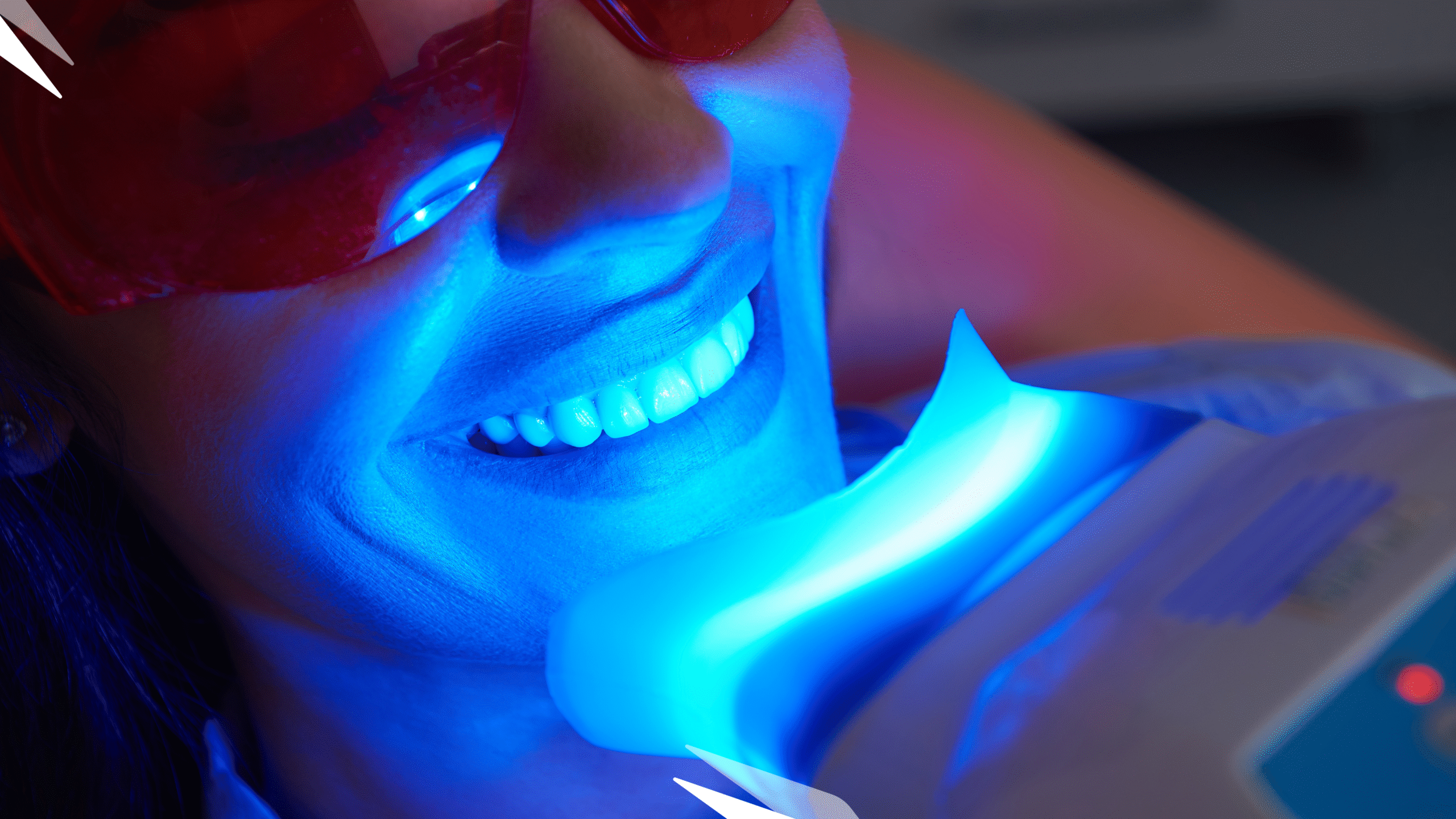 LED & Laser Teeth Whitening Near Me: Latest Safe Trends for 2025