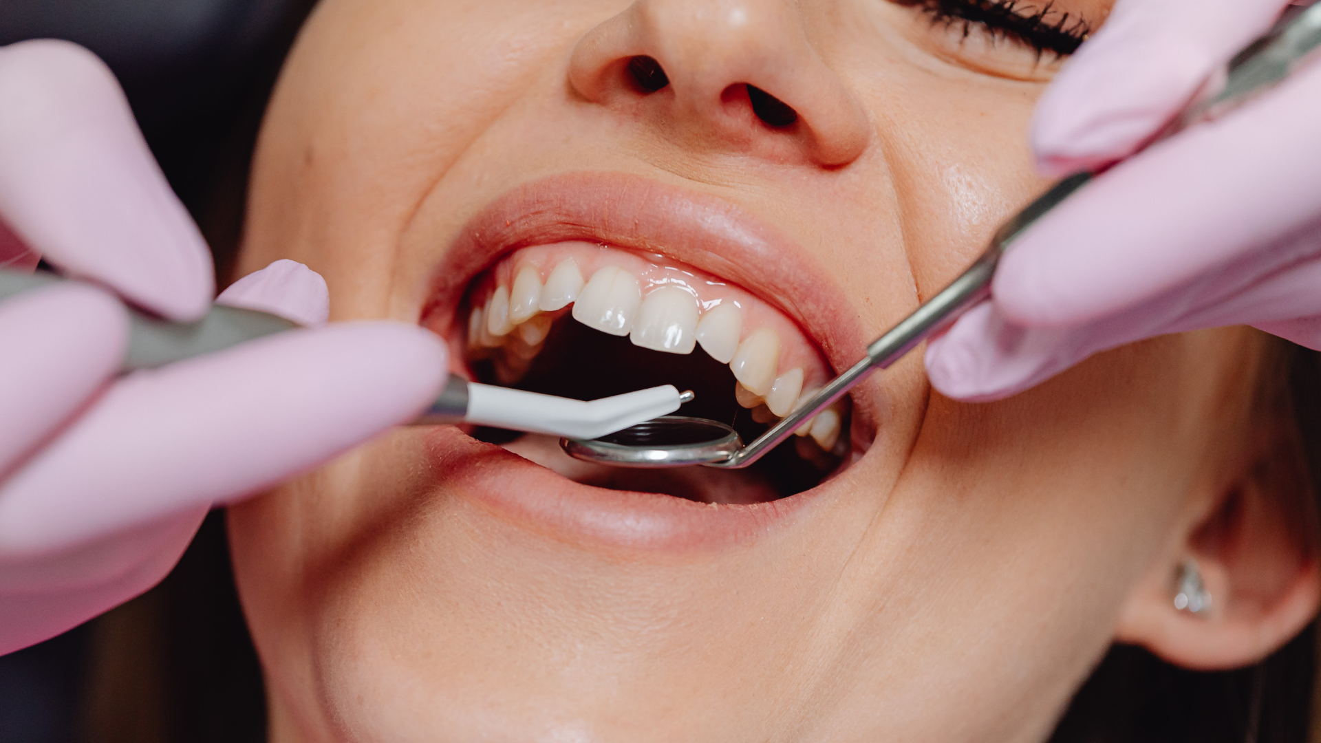 Dental Emergency? Here’s What to Do Before You Find the Best Dentist Near Me