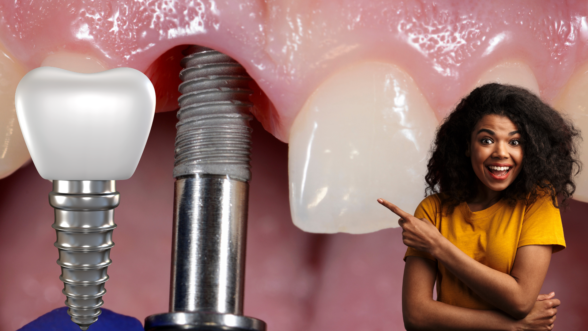 Dental Implants Prices & Success Rates in Ghaziabad