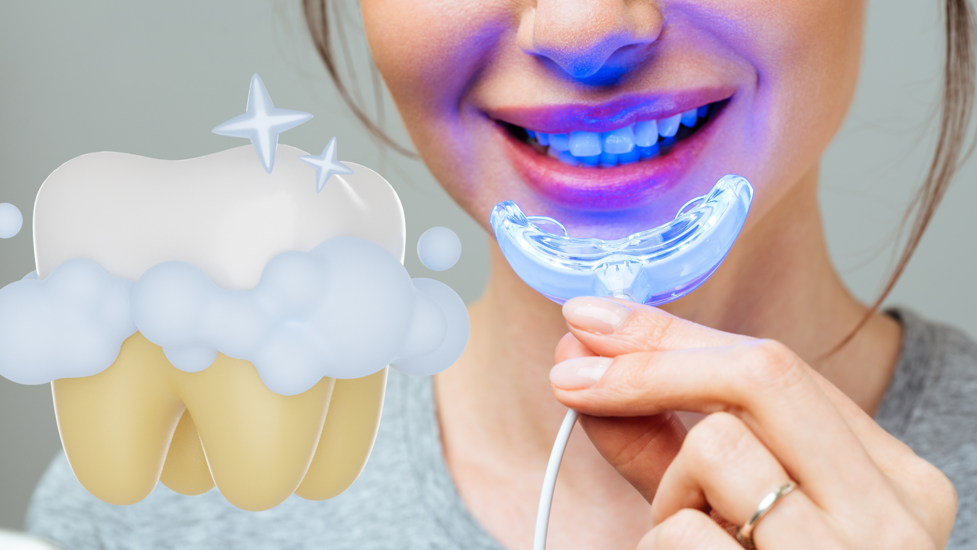 At‑Home vs. Clinic Teeth Whitening: What’s Best Near Me?