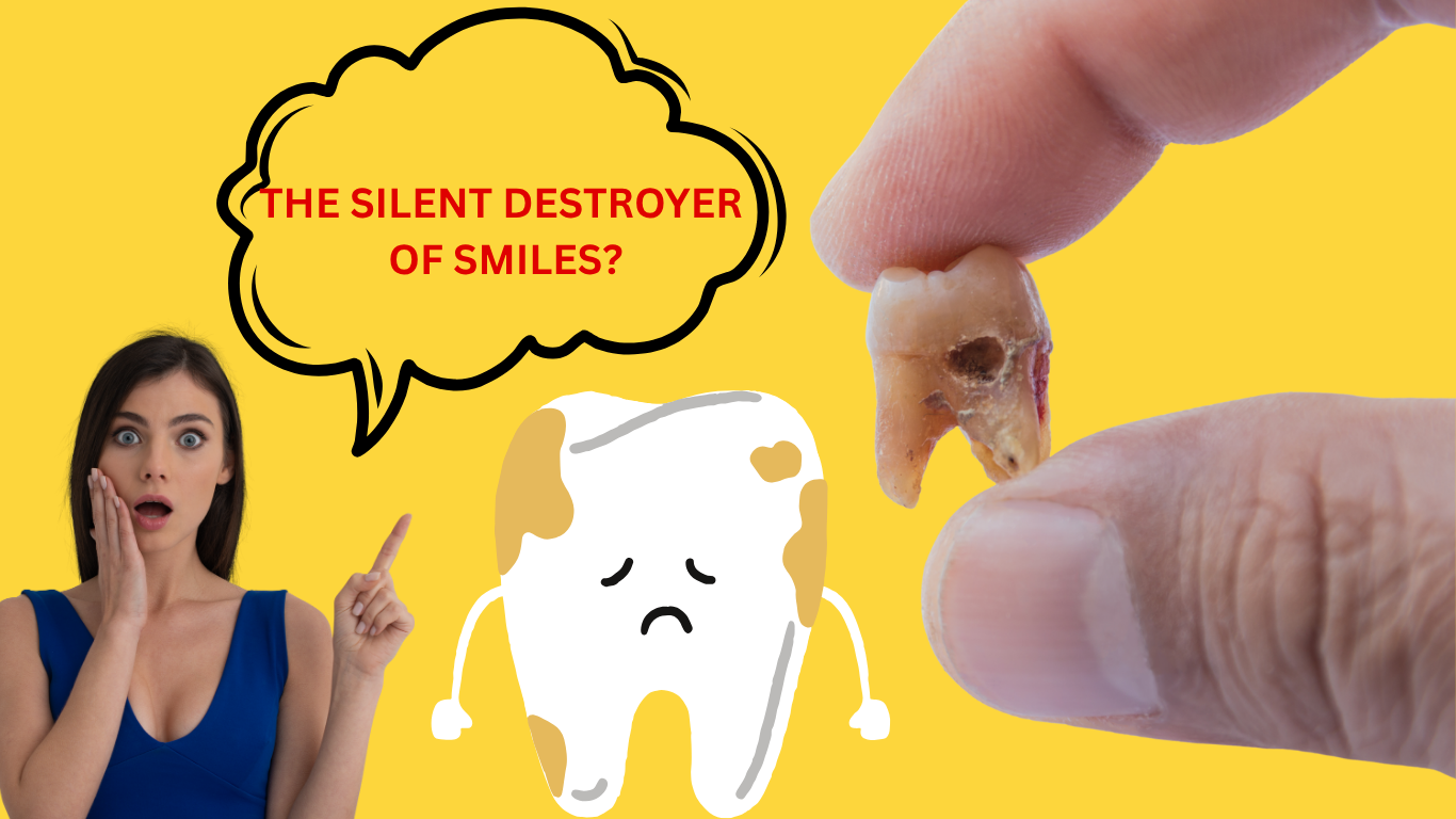 Tooth Decay: The Silent Destroyer of Smiles – Here’s What You Need to Know