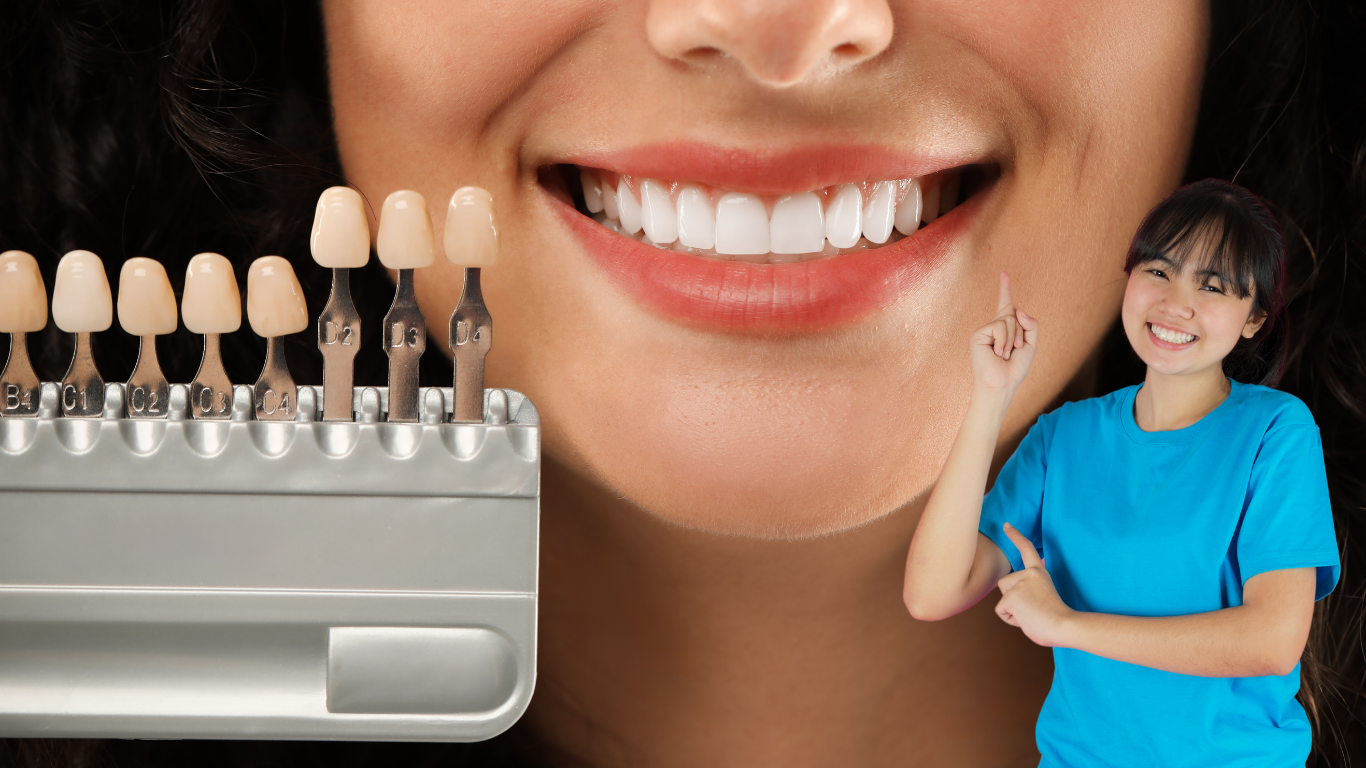 Looking for a Smile Upgrade? Here’s Why Dental Veneers Could Be Your Best Choice