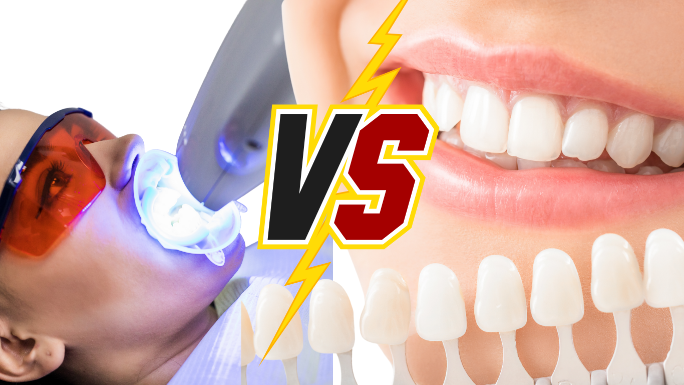 Whitening vs. Bleaching: What’s the Real Difference? A Complete Guide for Brighter Smiles
