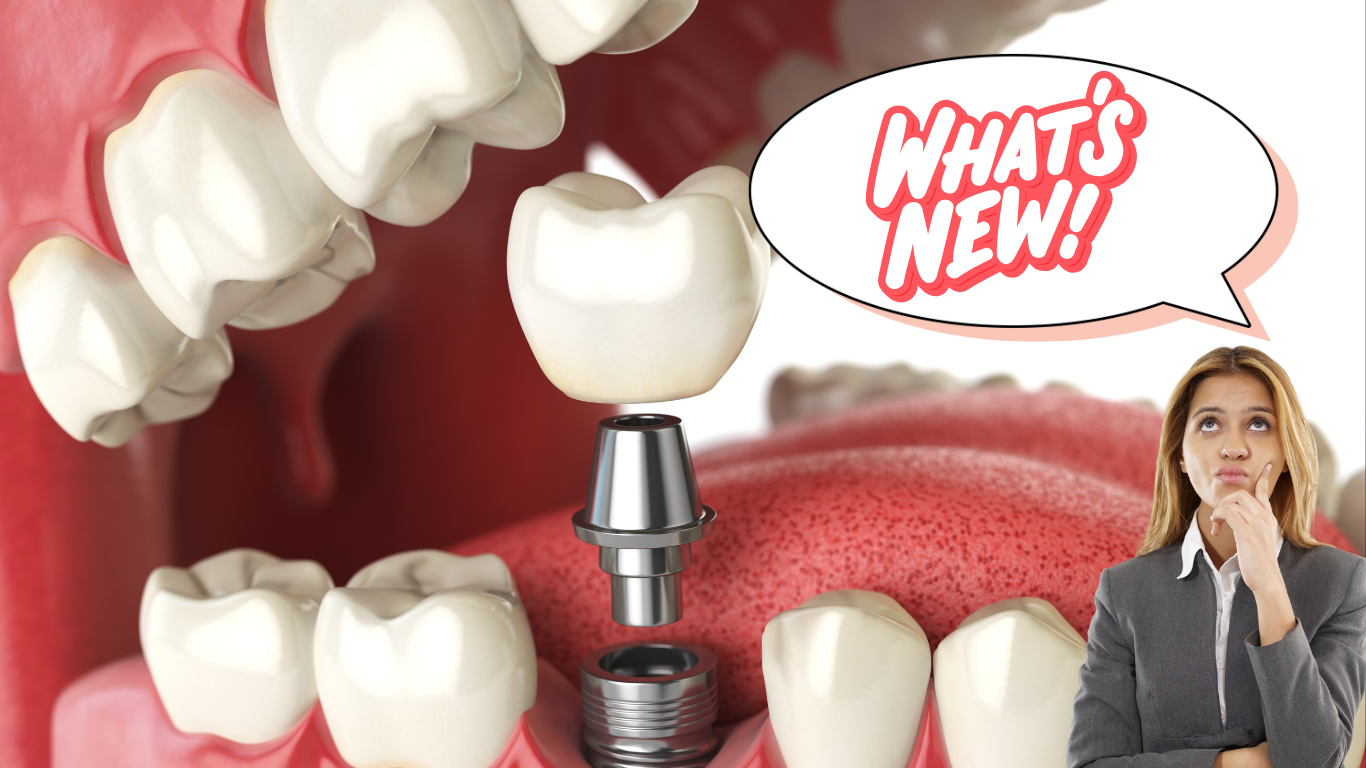 The Future of Smiles: What’s New in the World of Dental Implants?