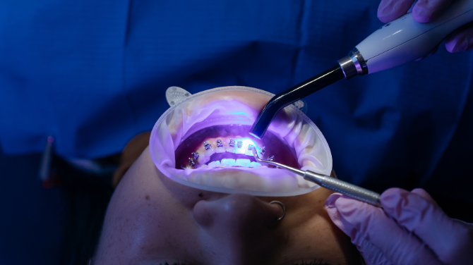 Dentist Near Me in Ghaziabad: Guide to Healthy Smiles