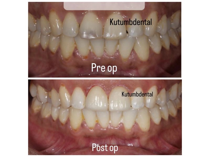 dentist near me Ghaziabad