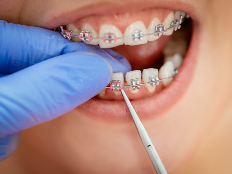 Top Orthodontist Near Me Ghaziabad Top Orthodontist Near Me Ghaziabad