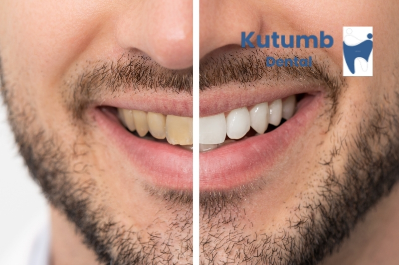 Find a Dentist Near Me in Vasundhara, Ghaziabad