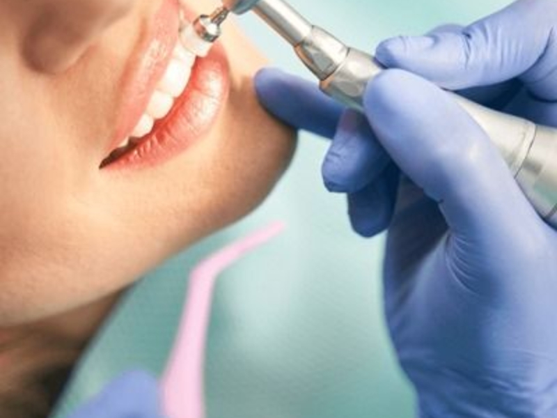 Teeth Cleaning Near Me: Healthy Smile Guide
