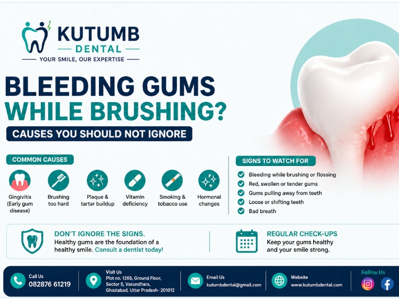 Bleeding Gums While Brushing? Causes You Should Not Ignore