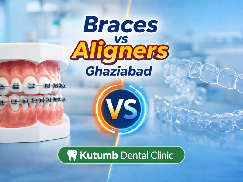 Braces vs Clear Aligners in Ghaziabad: Which is Better?
