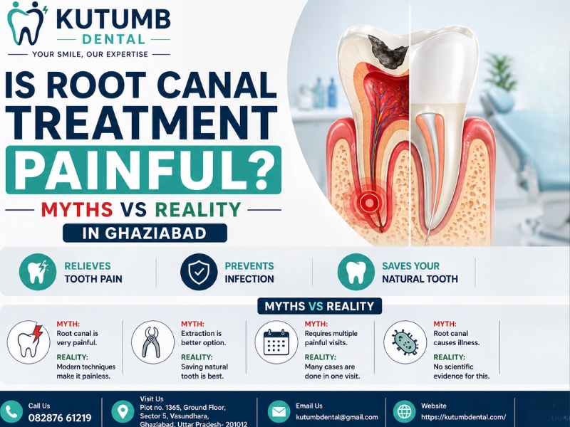 Root Canal Pain: Myths vs Reality in Ghaziabad