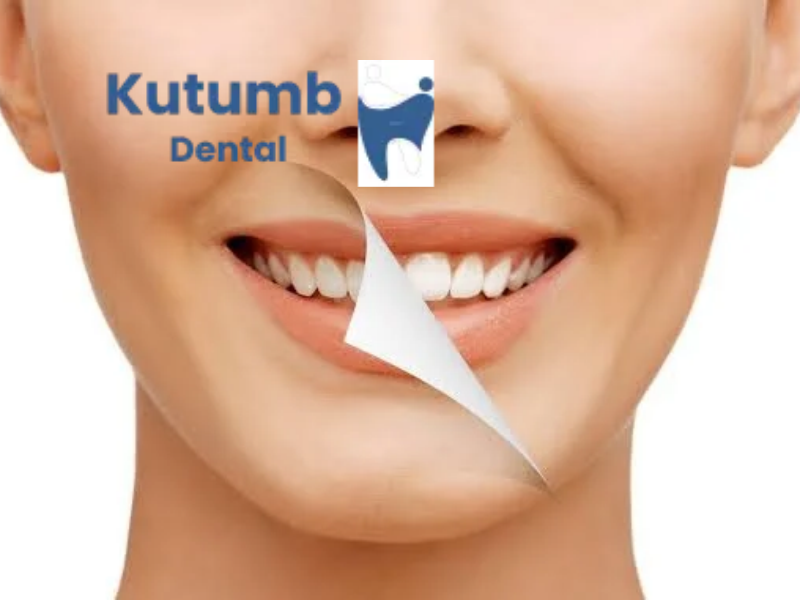 Smile makeover in Ghaziabad at Kutumb Dental Clinic