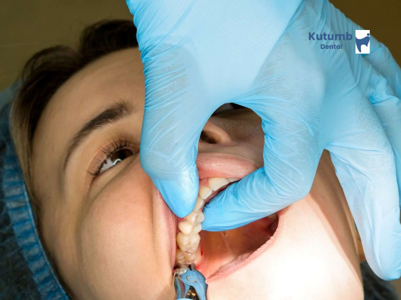 Wisdom Tooth Removal in Ghaziabad: Signs You May Need Treatment