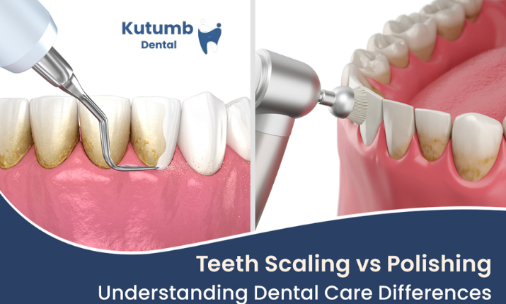 Scaling vs Polishing: Differences, Benefits and Dental Care After Cleaning