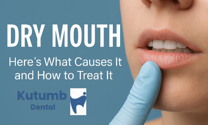 Dry Mouth and Oral Health