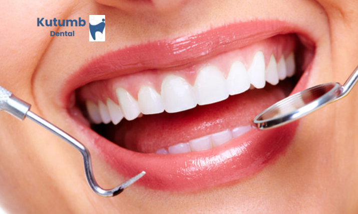 Dental Bonding in Ghaziabad