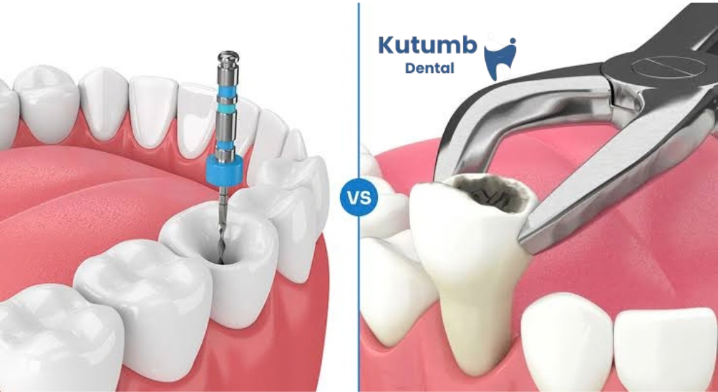 Tooth Extraction in Ghaziabad: When Is It Needed and What to Expect?