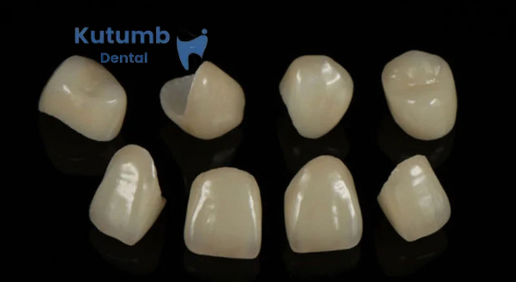 Dental Crown Treatment in Ghaziabad: When Do You Need a Dental Crown?